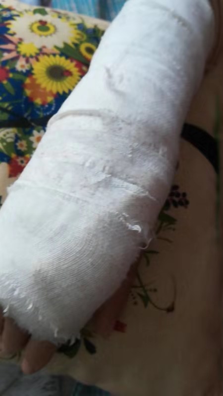 顧客因地面污物滑倒摔成骨折，安陽沃爾瑪推卸責任良心何在