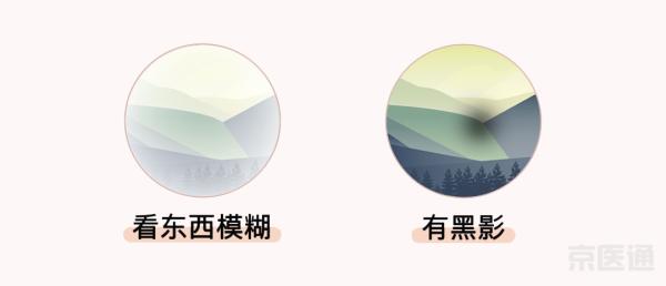 同仁醫(yī)生:4個(gè)眼科測(cè)試圖,1分鐘測(cè)眼睛是否健康！