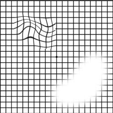 同仁醫(yī)生:4個(gè)眼科測(cè)試圖,1分鐘測(cè)眼睛是否健康！