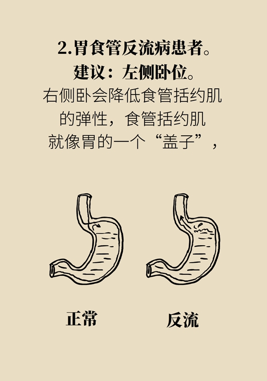 朝左邊睡會壓著心臟？ 這七類人睡姿有講究