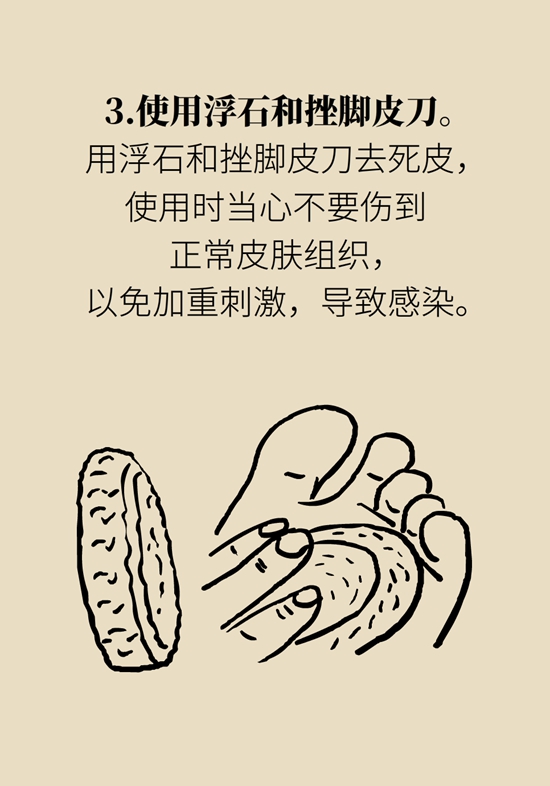 長了雞眼和老繭怎么辦？這份防治指南請收好