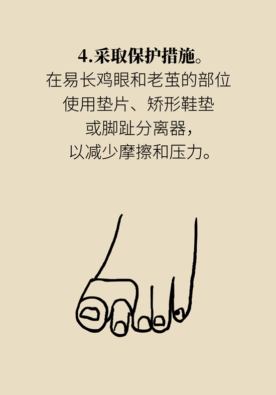 長了雞眼和老繭怎么辦？這份防治指南請收好