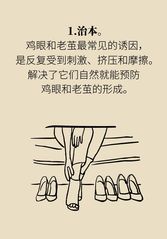 長了雞眼和老繭怎么辦？這份防治指南請收好