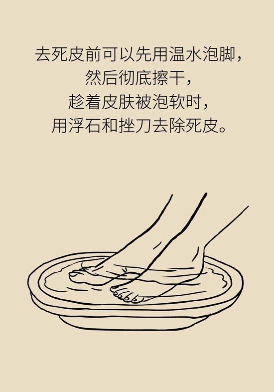 長了雞眼和老繭怎么辦？這份防治指南請收好