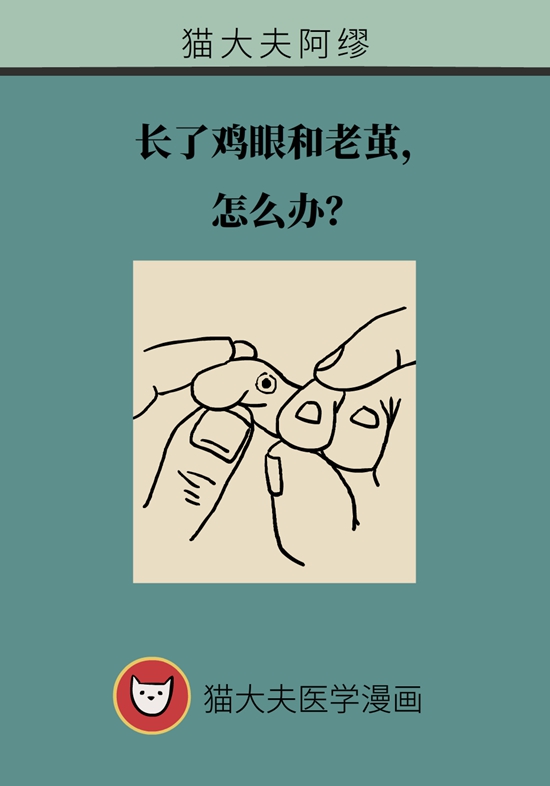 長了雞眼和老繭怎么辦？這份防治指南請收好
