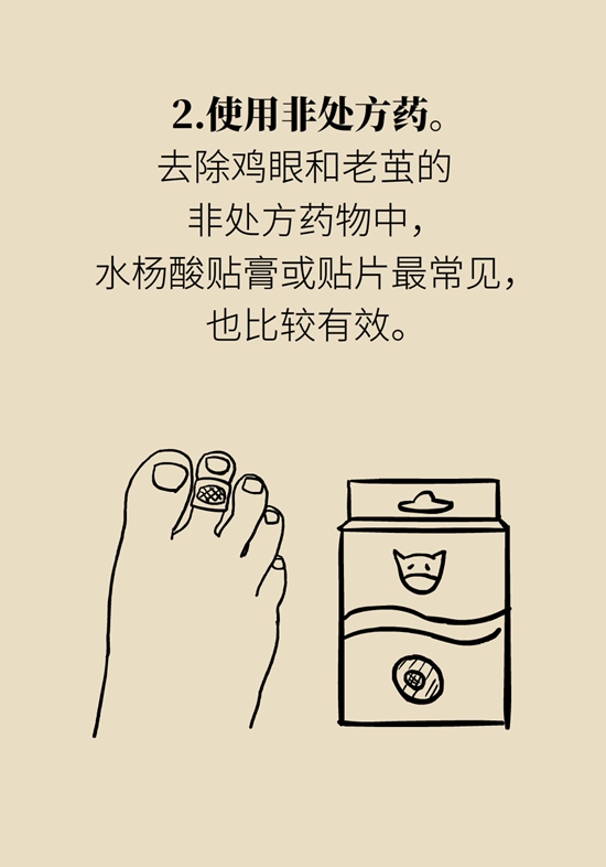 長了雞眼和老繭怎么辦？這份防治指南請收好