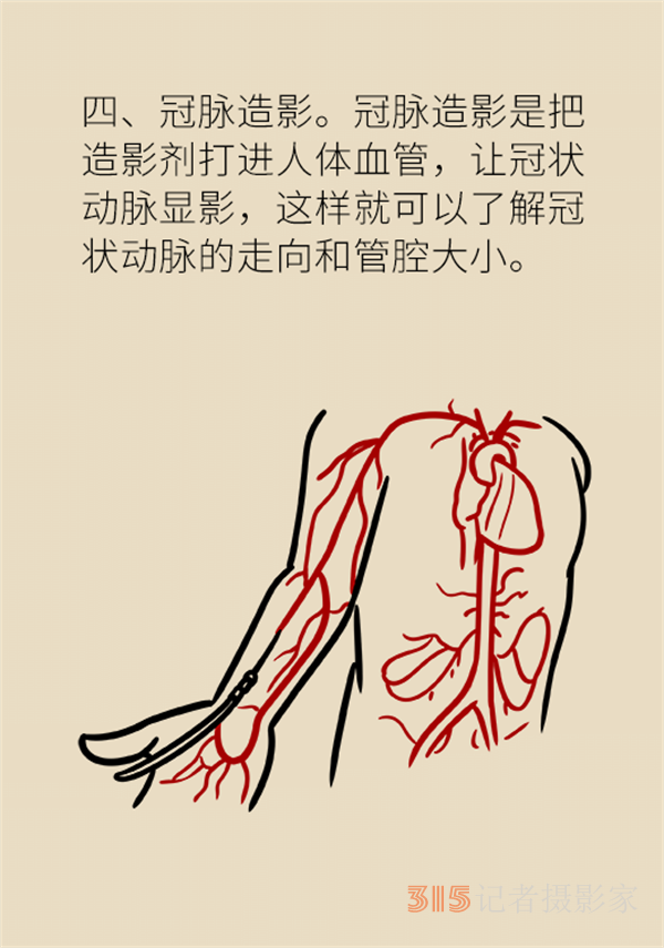 老人心血管疾病高發(fā)，這些常用檢查方法務(wù)必了解