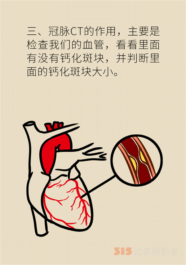 老人心血管疾病高發(fā)，這些常用檢查方法務(wù)必了解