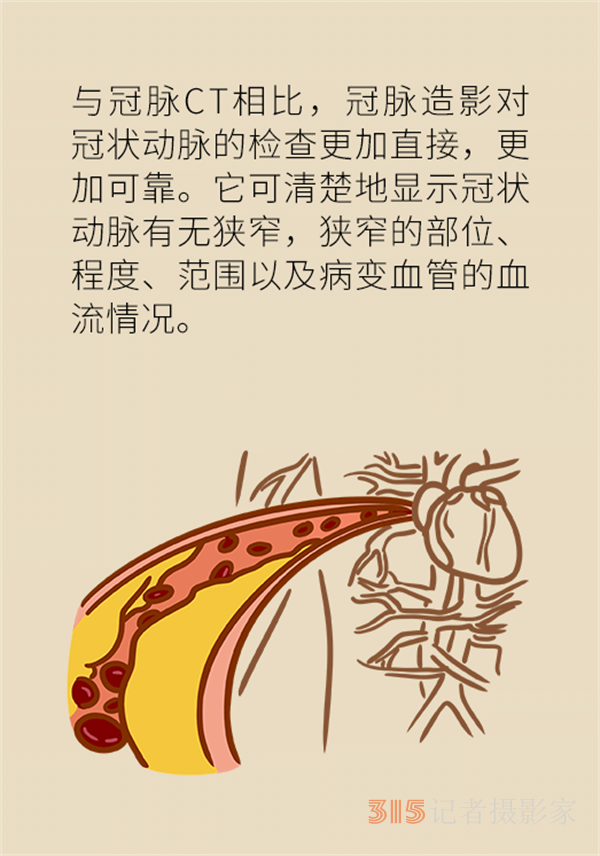 老人心血管疾病高發(fā)，這些常用檢查方法務(wù)必了解