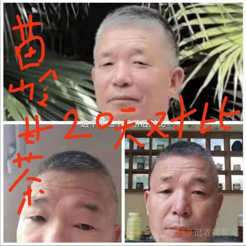 苗醫(yī)慢病快治專(zhuān)家范景良