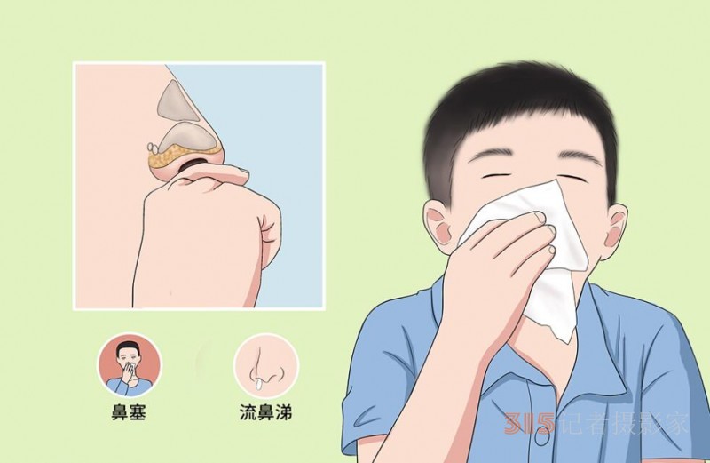 打噴嚏、流鼻涕、鼻塞、呼吸困難、眼睛腫、耳朵癢——原來(lái)還有這樣出奇的療愈方法