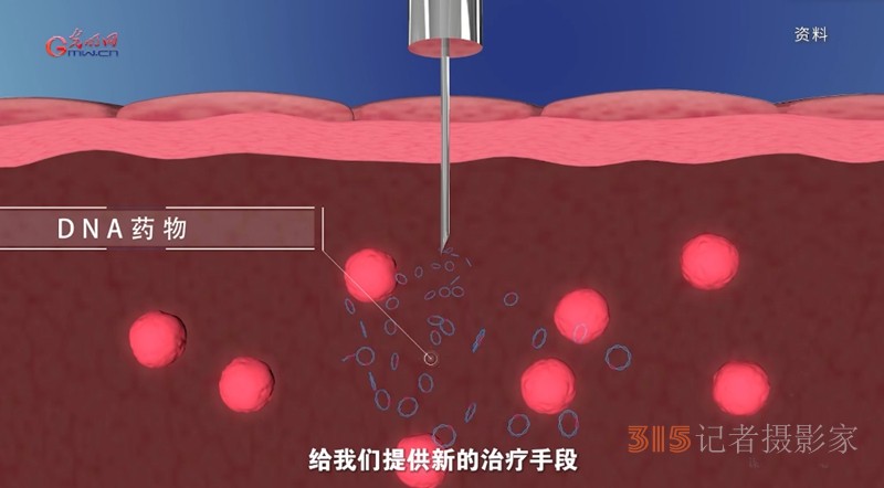 宮頸癌消滅戰(zhàn)：如何減少“梅艷芳式悲劇”？
