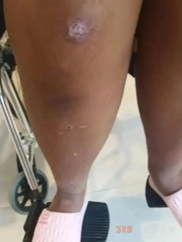 河南一教育機構(gòu)教官被指體罰14歲女生致其昏迷！多方介入，教育局：成立工作專班